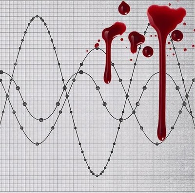 Noise Test presents: Blood Test at The Jam Jar at Jam Jar
