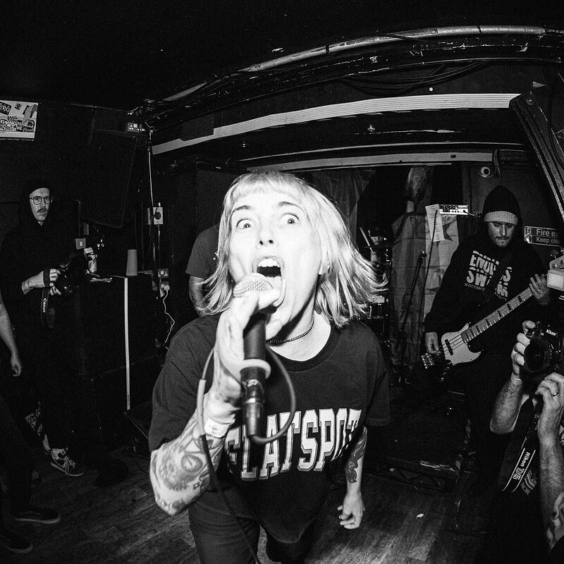 Dry Socket at Exchange