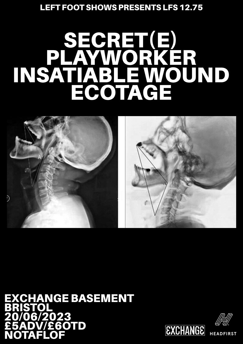 Secret, Playworker, Insatiable Wound & ecotage at Exchange